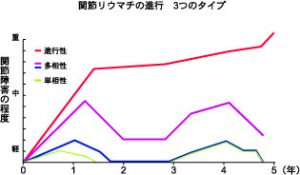 関節リウマチの進行　3つのタイプ